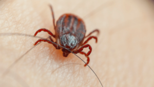 tick and mosquito removal