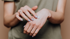 How To Soothe A Mosquito Bite In Toronto